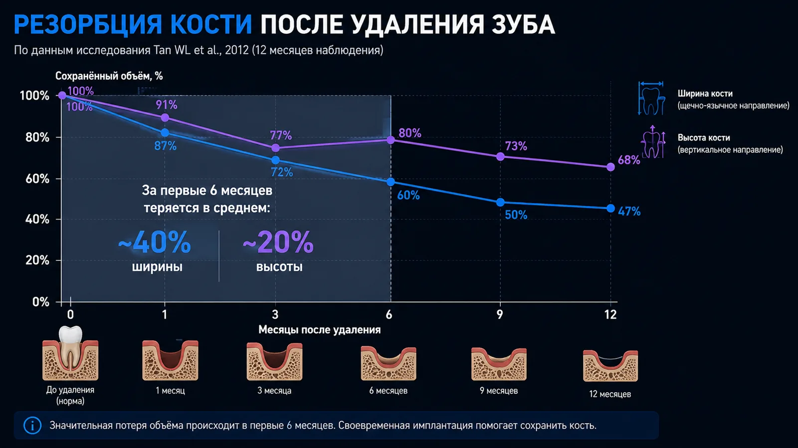 Диаграмма убыли костной ткани по месяцам после удаления зуба