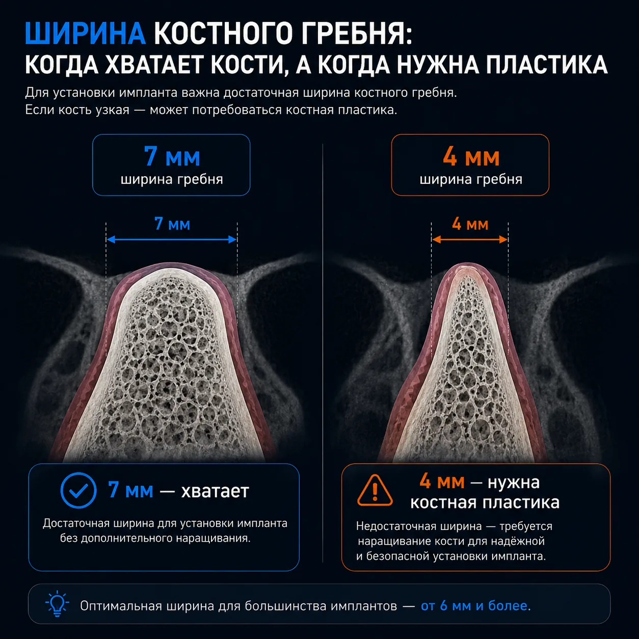 Поперечный срез челюсти с измерением ширины альвеолярного гребня